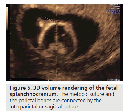 imaging-in-medicine-fetal-splanchnocranium