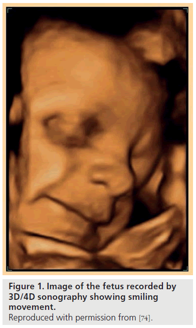 imaging-in-medicine-fetus-recorded