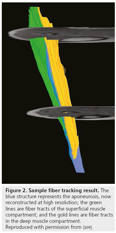 imaging-in-medicine-fiber-tracking