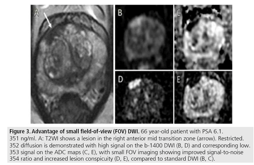 imaging-in-medicine-field-of-view