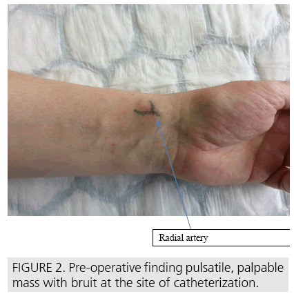 imaging-in-medicine-finding-pulsatile