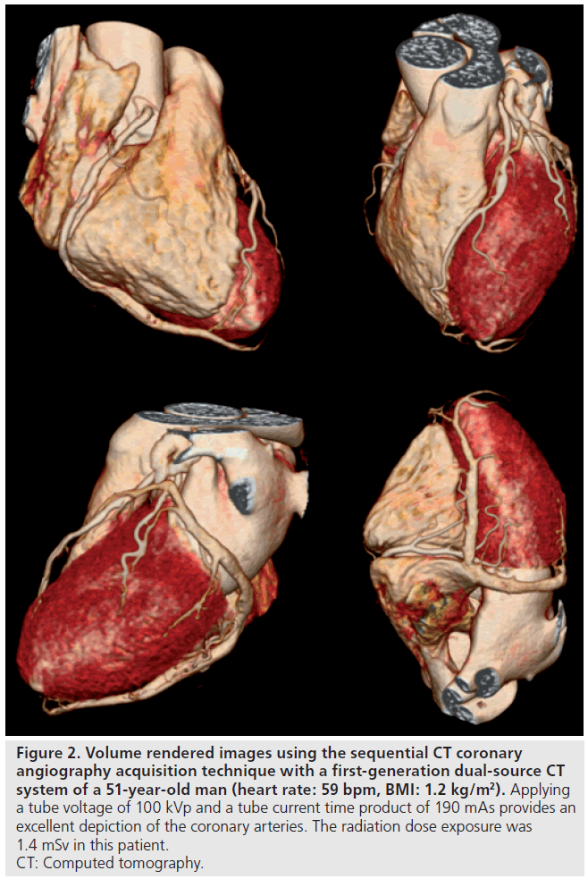 imaging-in-medicine-first-generation