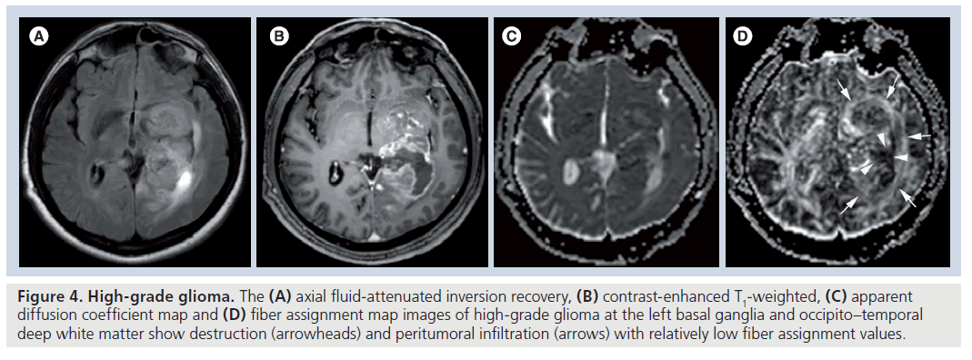 imaging-in-medicine-fluid-attenuated