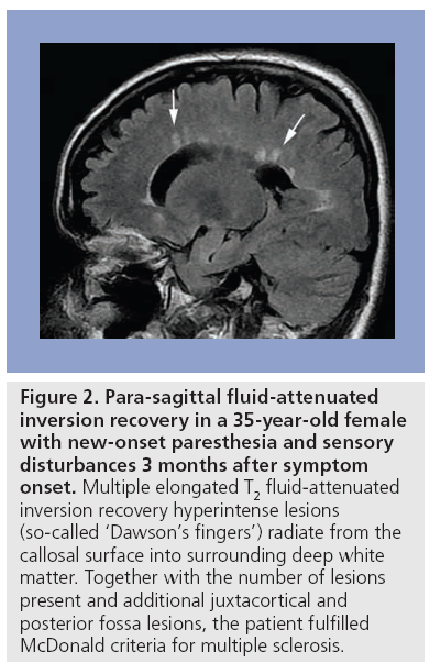 imaging-in-medicine-fluid-attenuated