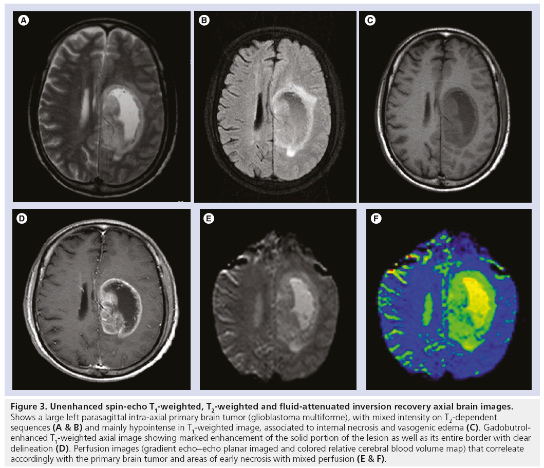 imaging-in-medicine-fluid-attenuated