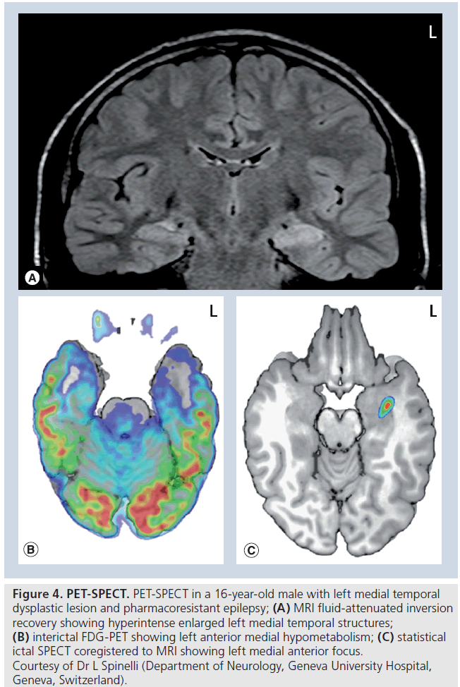 imaging-in-medicine-fluid-attenuated