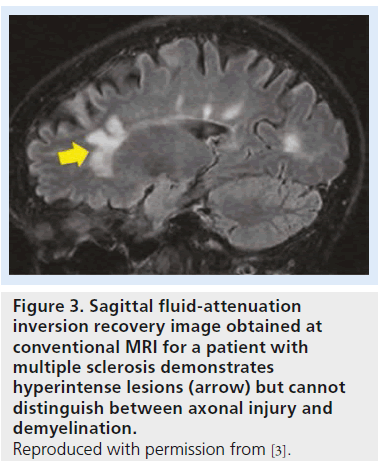 imaging-in-medicine-fluid-attenuation