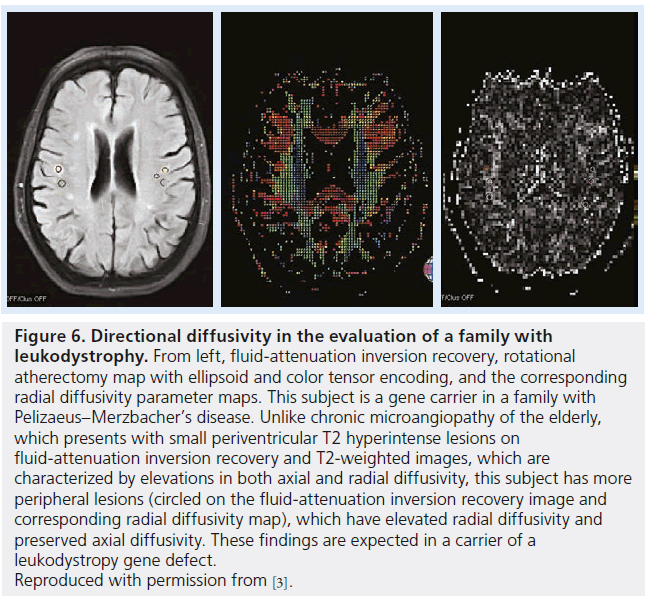 imaging-in-medicine-fluid-attenuation