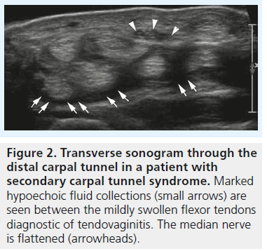 imaging-in-medicine-fluid-collections