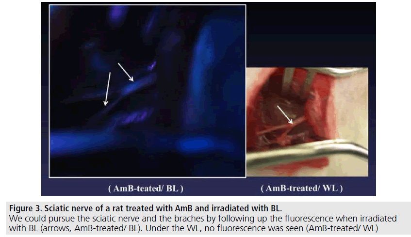 imaging-in-medicine-fluorescence-irradiated