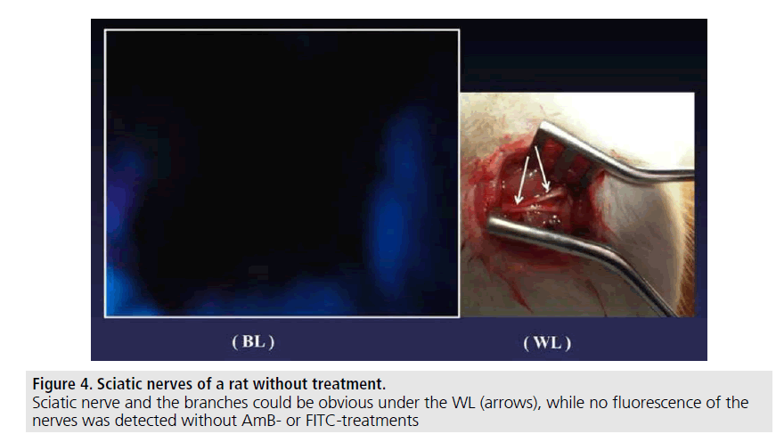 imaging-in-medicine-fluorescence-nerves