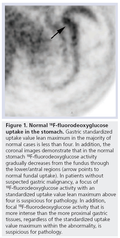 imaging-in-medicine-fluorodeoxyglucose