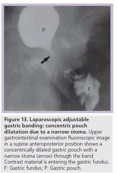 imaging-in-medicine-fluoroscopic-image