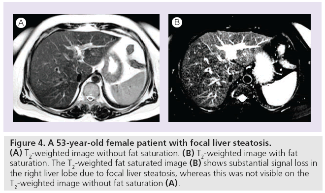 imaging-in-medicine-focal-liver