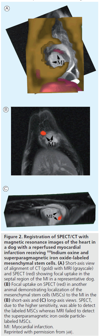 imaging-in-medicine-focal-uptake