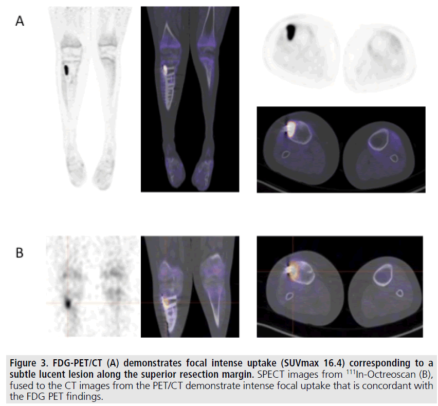 imaging-in-medicine-focal-uptake