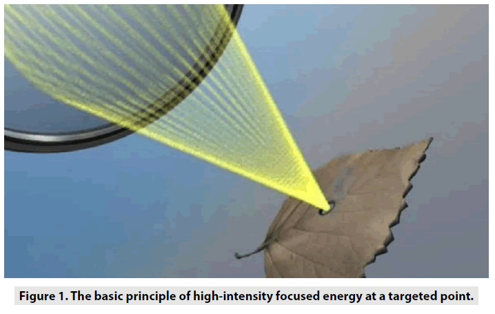 imaging-in-medicine-focused-energy