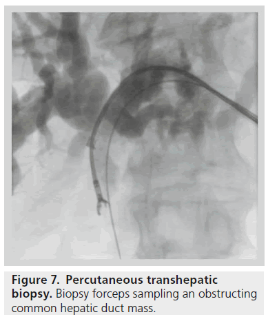 imaging-in-medicine-forceps-sampling