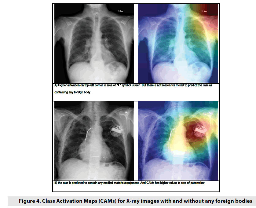imaging-in-medicine-foreign-bodies