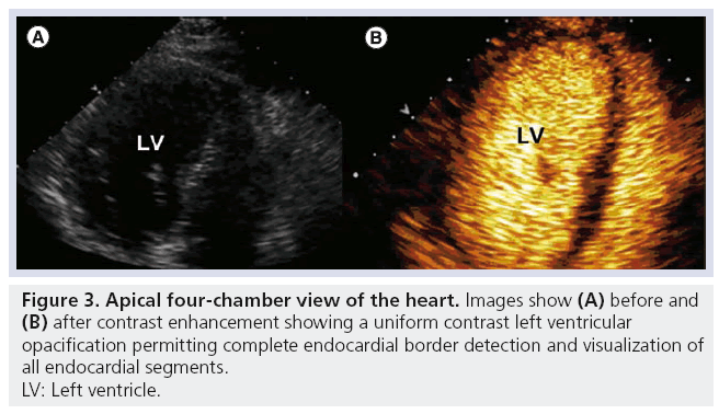 imaging-in-medicine-four-chamber