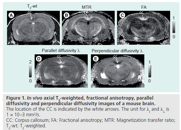 imaging-in-medicine-fractional-anisotropy