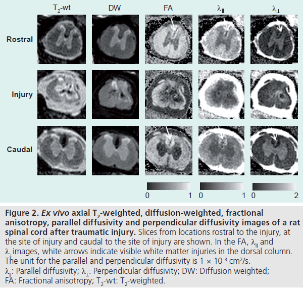 imaging-in-medicine-fractional-anisotropy