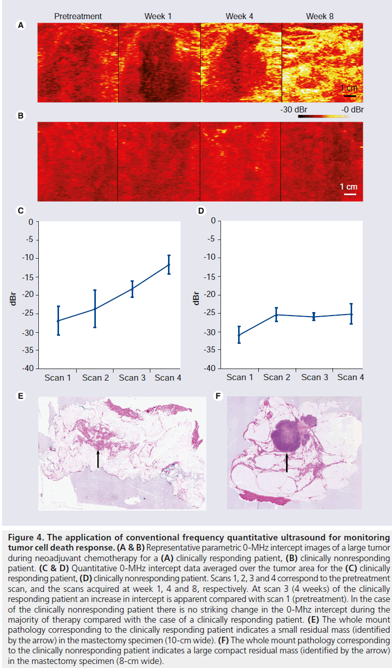 imaging-in-medicine-frequency-quantitative