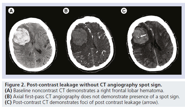 imaging-in-medicine-frontal-lobar
