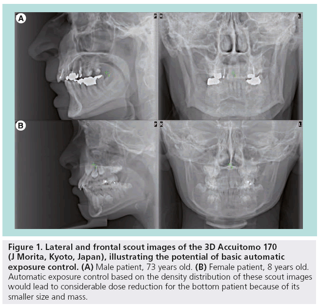 imaging-in-medicine-frontal-scout