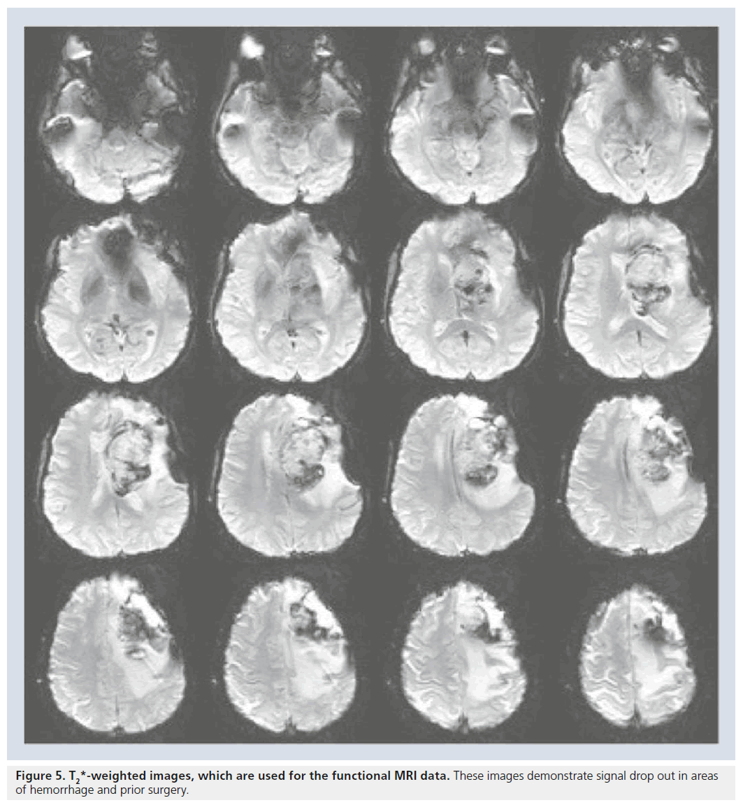 imaging-in-medicine-functional-MRI