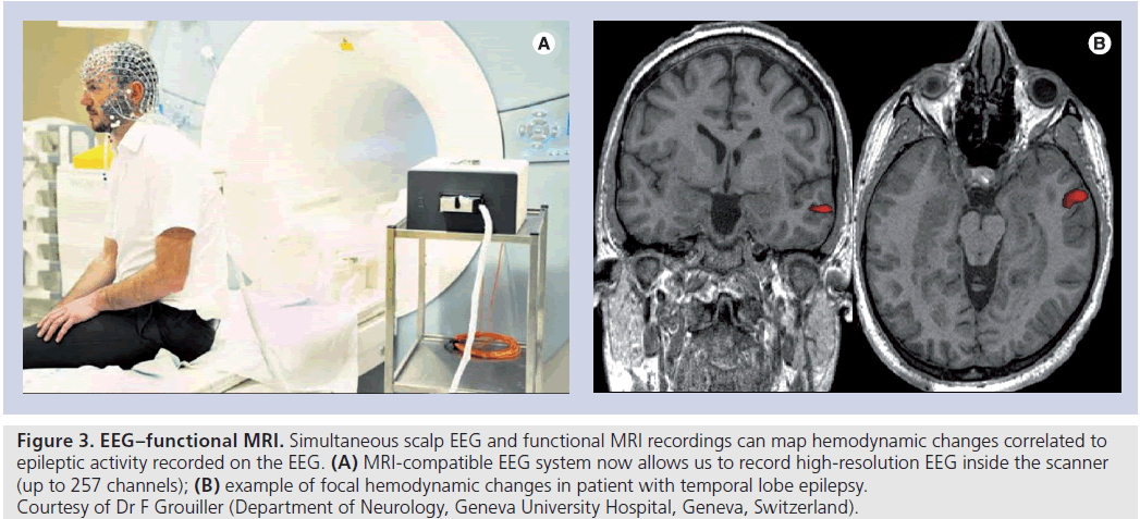 imaging-in-medicine-functional-MRI