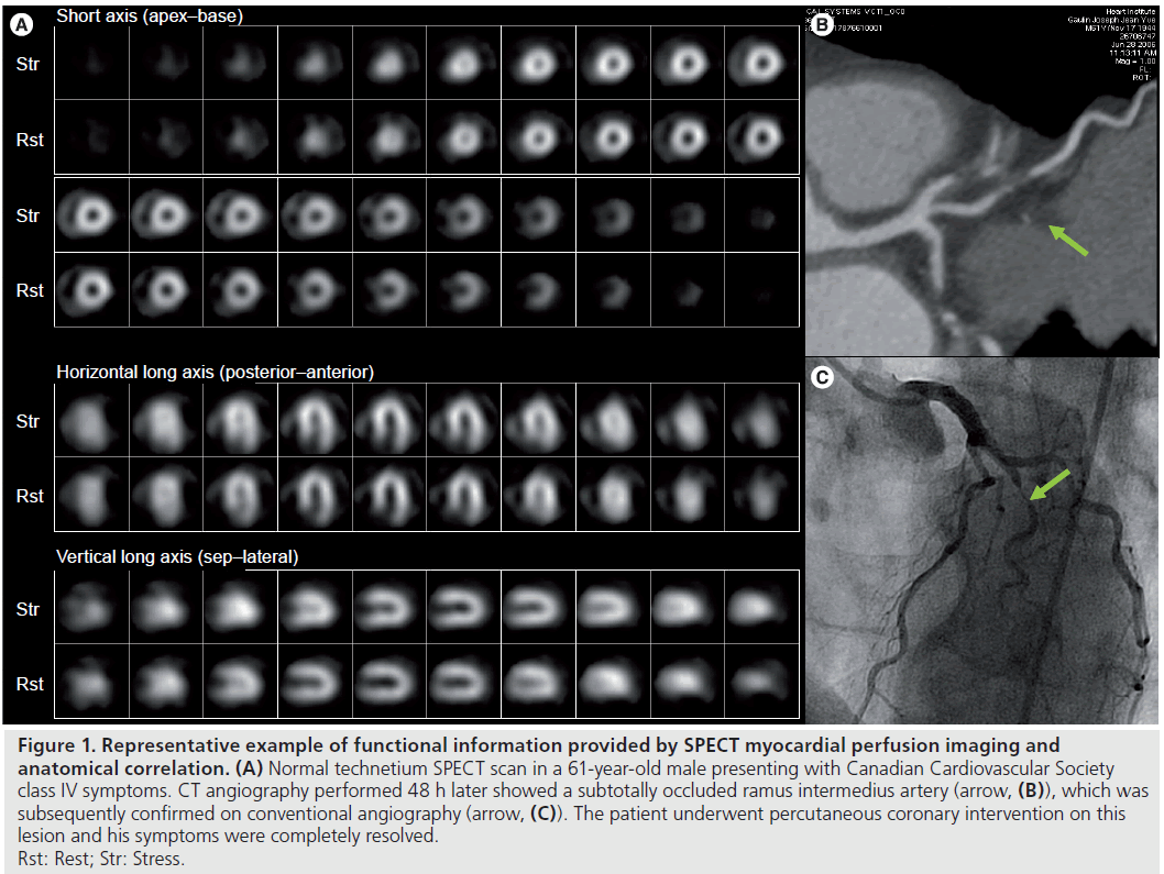 imaging-in-medicine-functional-information