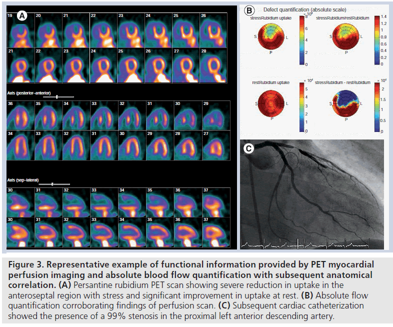 imaging-in-medicine-functional-information