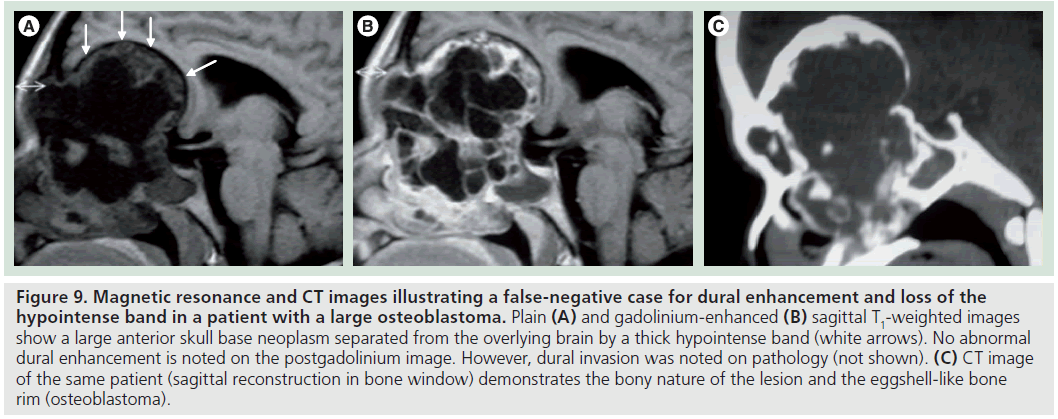 imaging-in-medicine-gadolinium-enhanced
