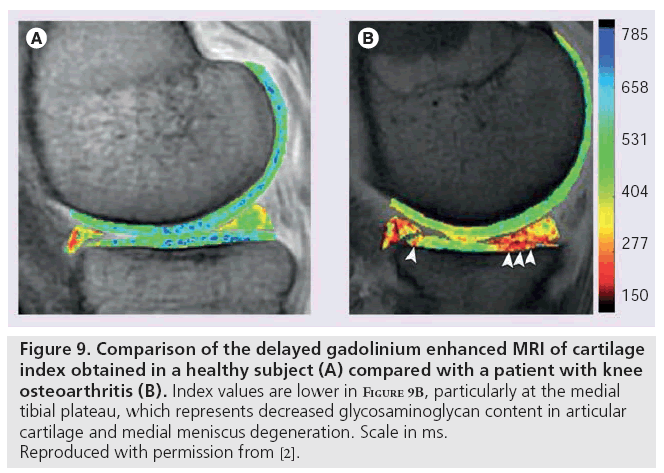imaging-in-medicine-gadolinium-enhanced
