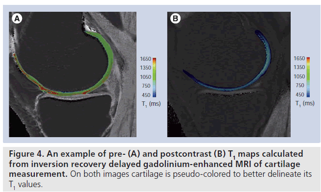 imaging-in-medicine-gadolinium–enhanced