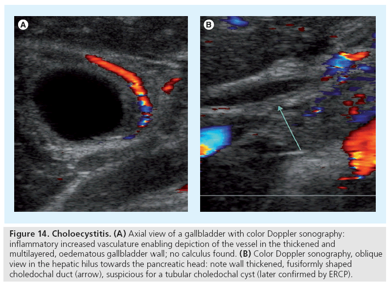 imaging-in-medicine-gallbladder