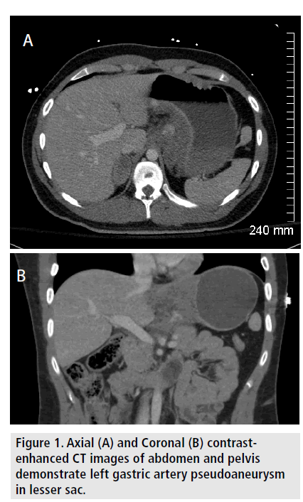 imaging-in-medicine-gastric-artery