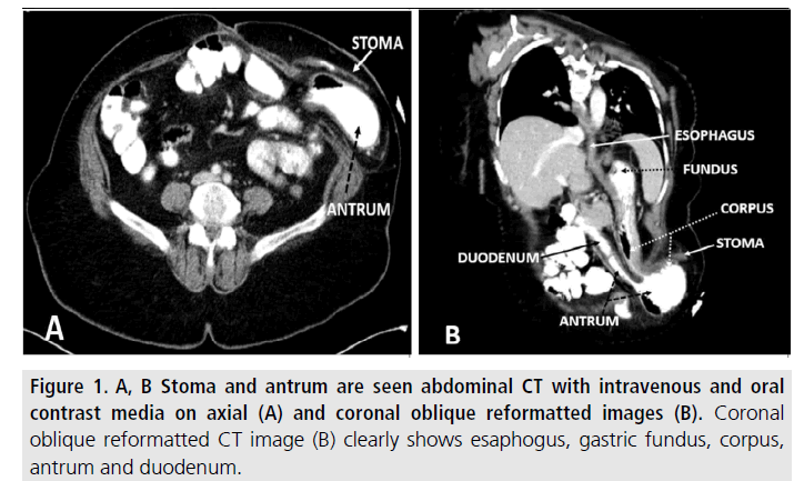 imaging-in-medicine-gastric-fundus