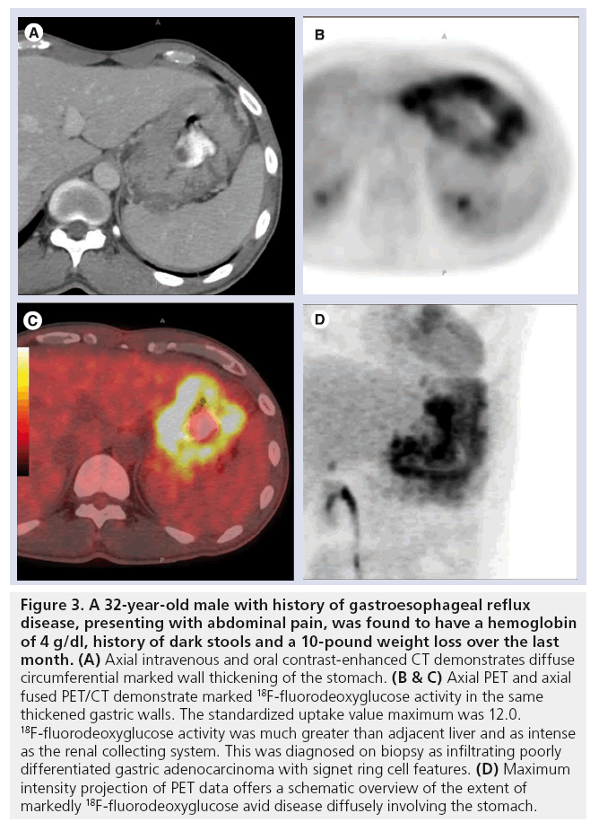 imaging-in-medicine-gastroesophageal