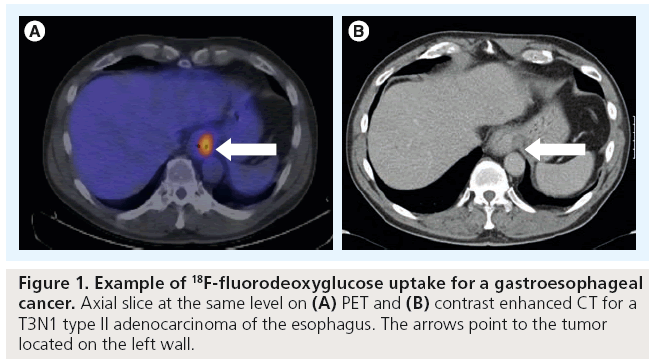 imaging-in-medicine-gastroesophageal