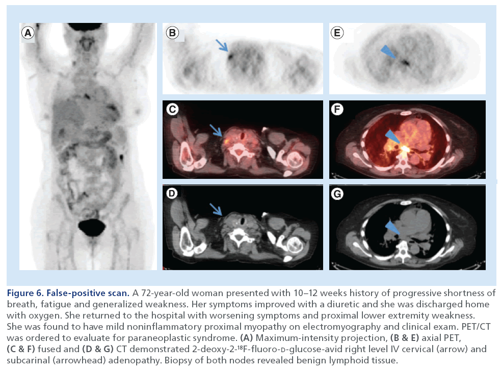 imaging-in-medicine-generalized-weakness