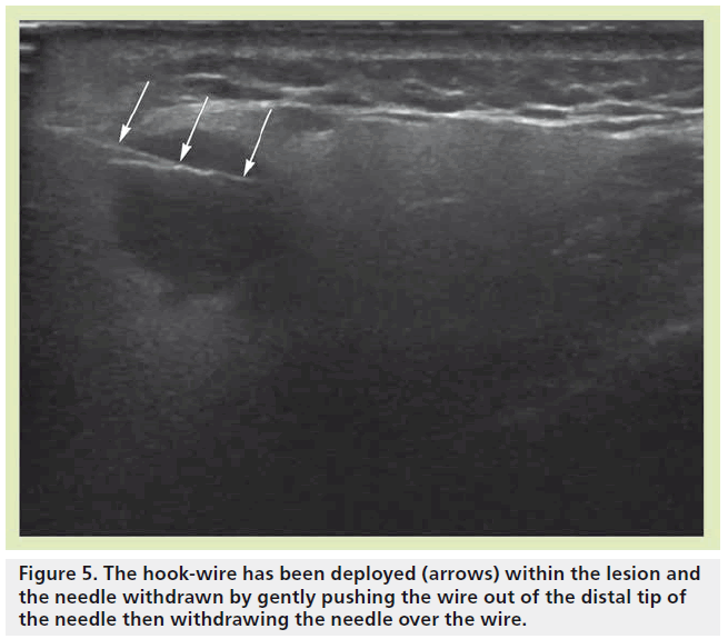 imaging-in-medicine-gently-pushing