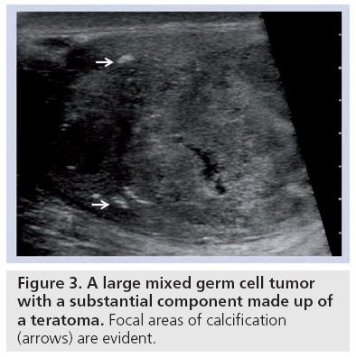 imaging-in-medicine-germ-cell