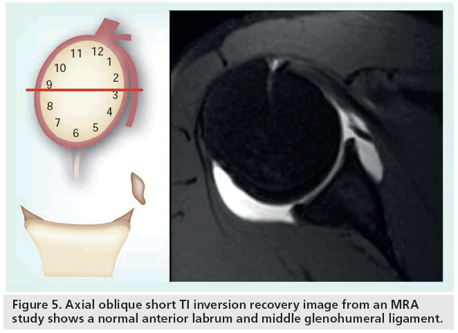 imaging-in-medicine-glenohumeral
