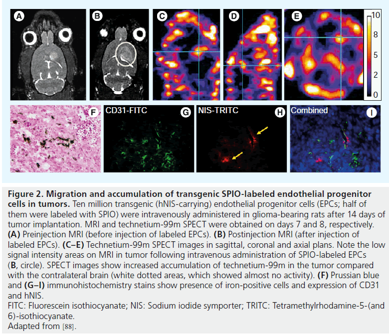 imaging-in-medicine-glioma-bearing