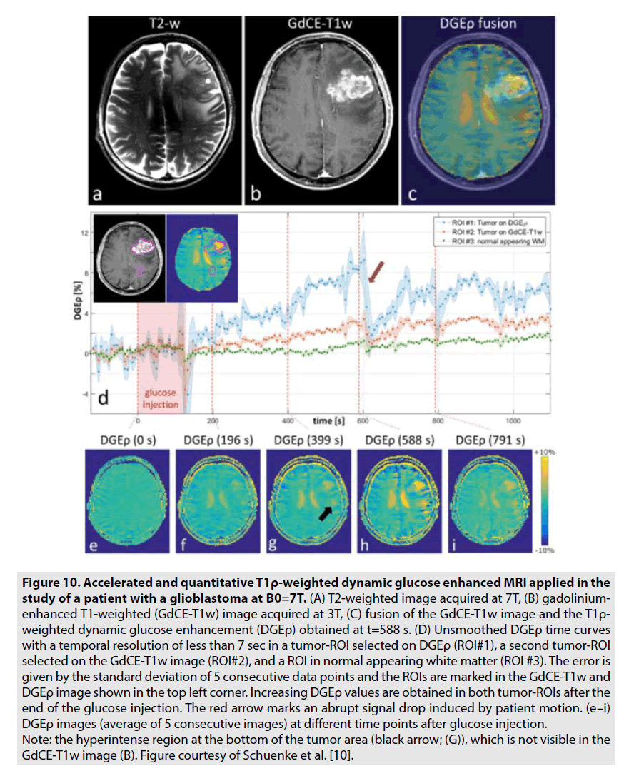 imaging-in-medicine-glucose-enhancement