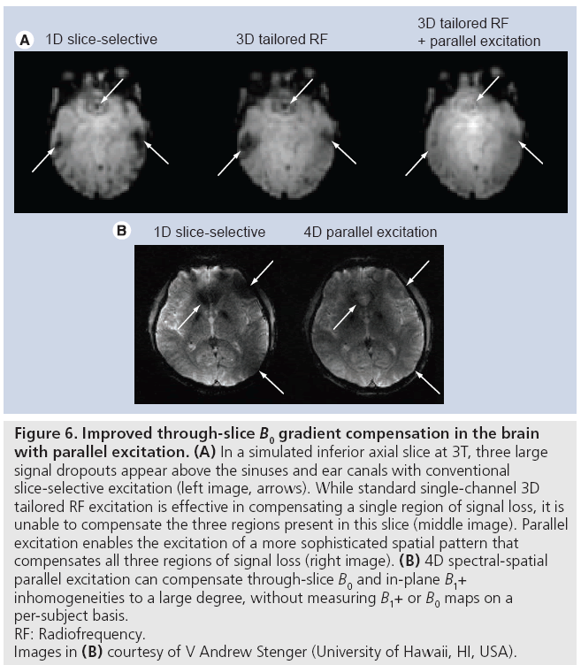 imaging-in-medicine-gradient-compensation