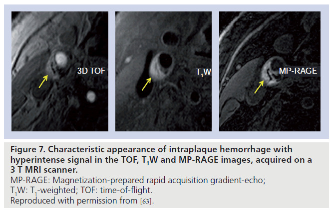 imaging-in-medicine-gradient-echo