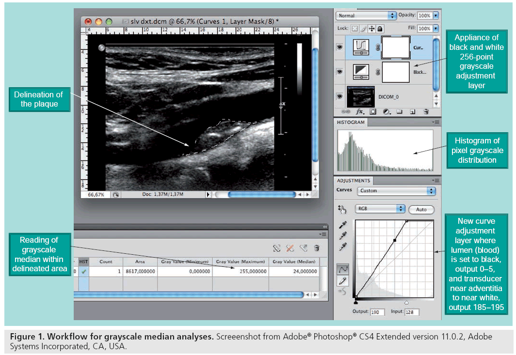 imaging-in-medicine-grayscale-median